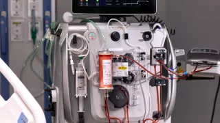 PrismaLung+ enables ECCO2R therapy