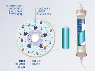 Oxiris is the ONLY blood purification filterset to effectively remove inflammatory mediators, endotoxin, fluid and uremic toxins SIMULTANEOUSLY.1-5