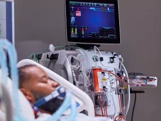 PrismaLung+ enables ECCO2R therapy